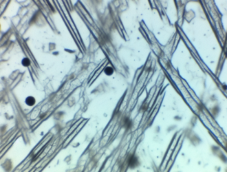 A microscopic view of asbestos fibers